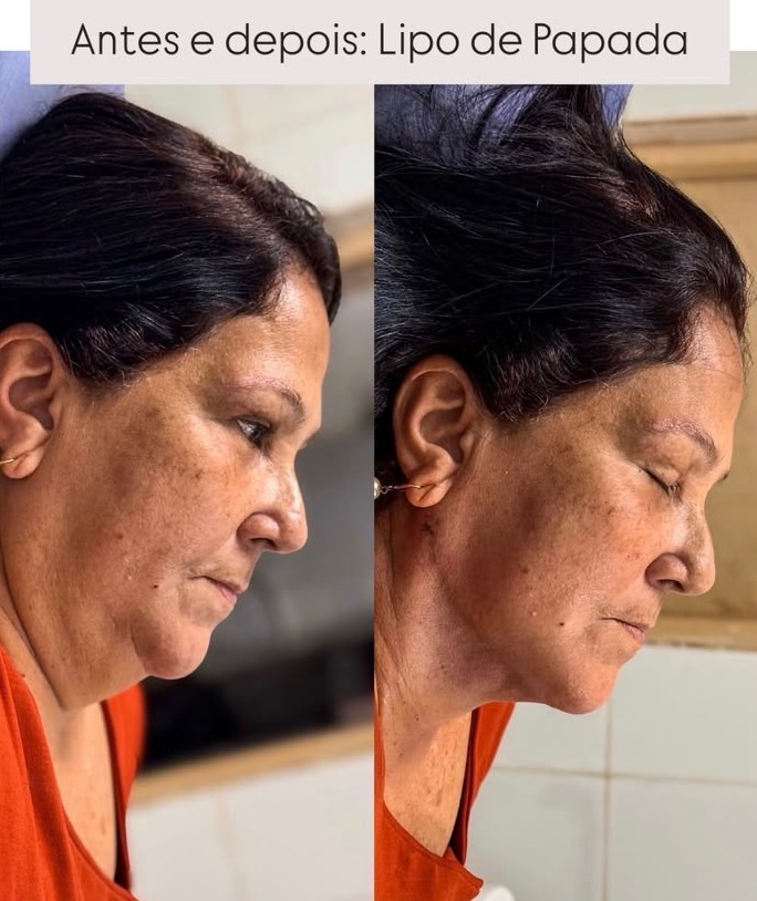 Caso 01 — Definição de mandíbula — foto 1