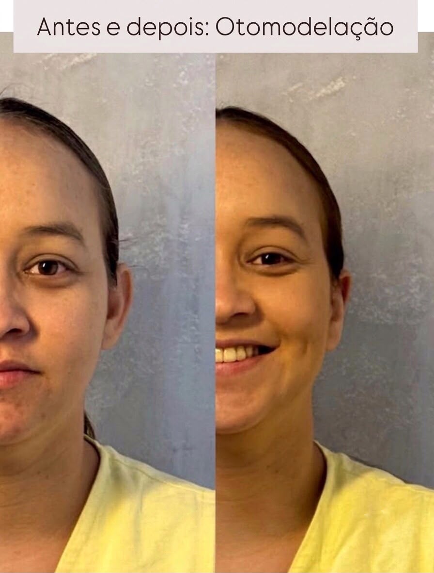 Caso 01 — Antes e depois — foto 1